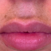 Reviewer showing their upper lip hair