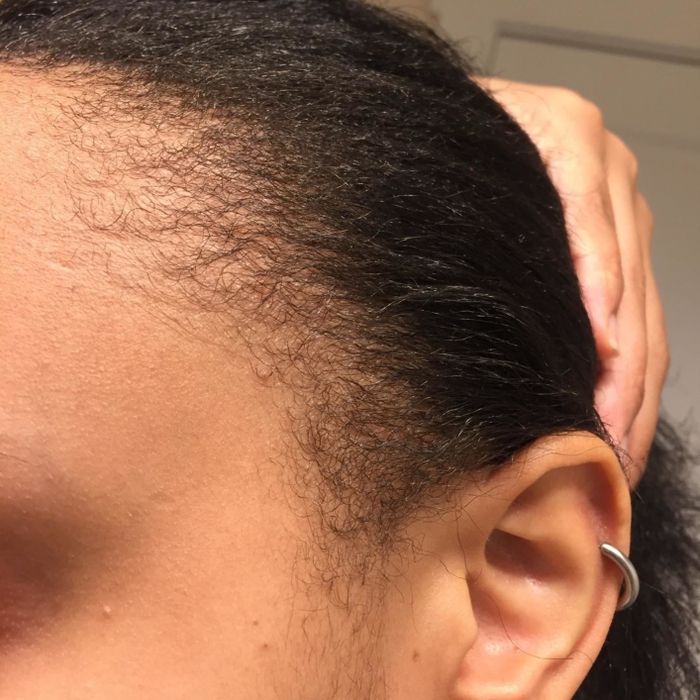 A before photo of the reviewer's natural edges and baby hairs.