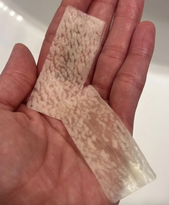 A hand displaying two used pore strips with visible extracted debris