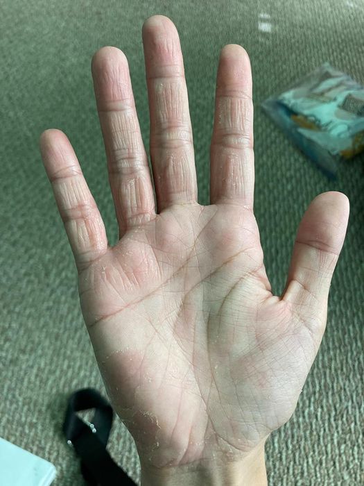 after image of the same hand now appearing smooth and well-hydrated