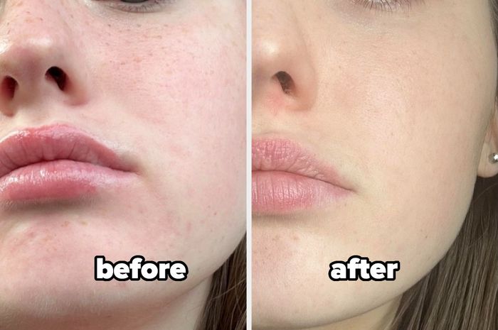 Before-and-after photos showing the reviewer’s brighter, more even skin tone after using the serum
