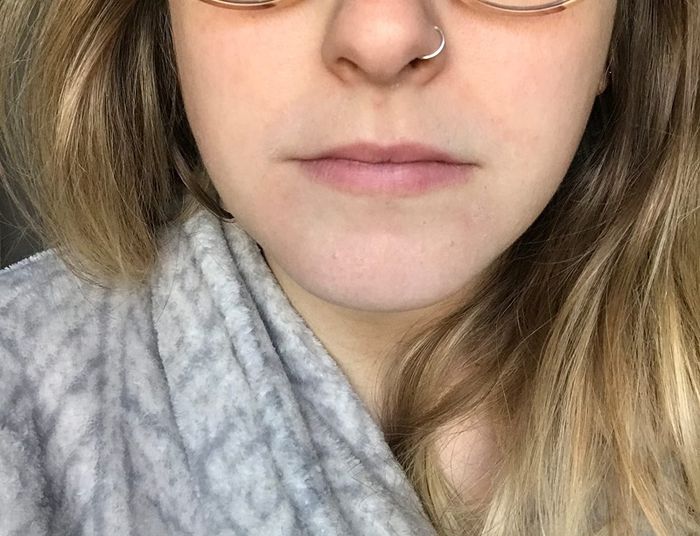 after image of the same reviewer showing clear and well-hydrated skin