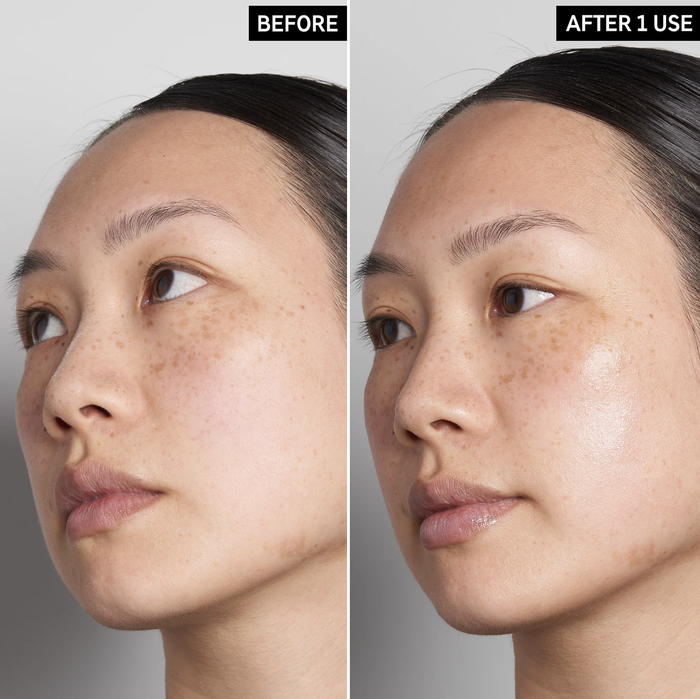 A side-by-side comparison of a person's facial skin before and after using the product