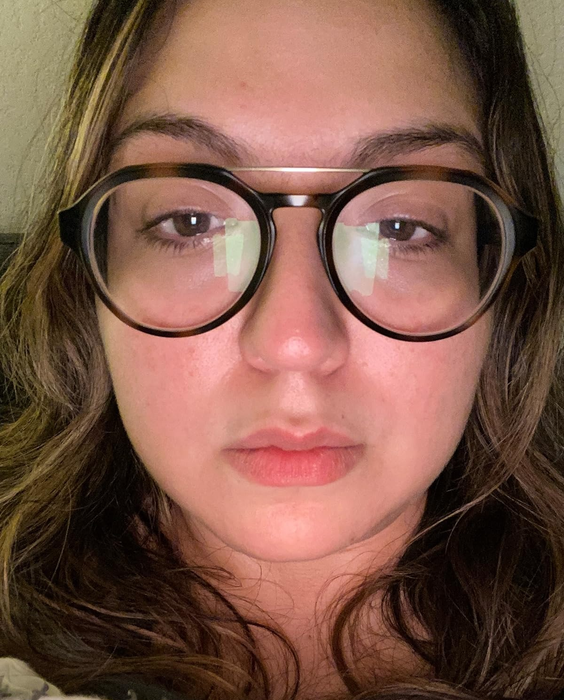 A follow-up image of the same reviewer showing significantly clearer and healthier skin