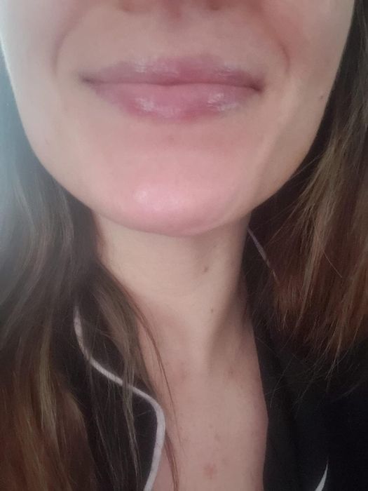 after image of the same reviewer with soft, hydrated lips