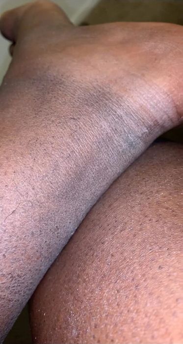 A close-up of a person’s arm displaying a noticeable tan line where the skin has been exposed to sunlight