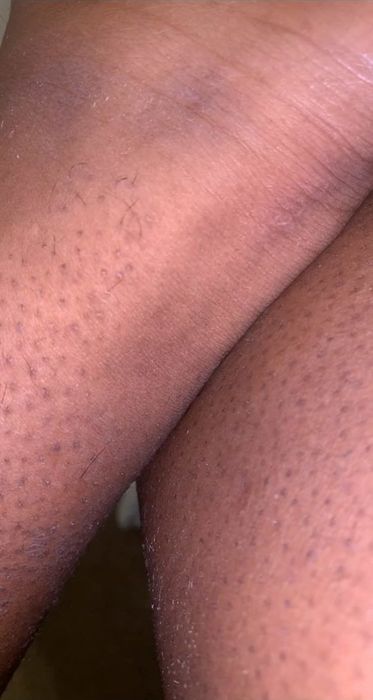A detailed close-up of a person’s legs, showcasing skin texture and hair follicles