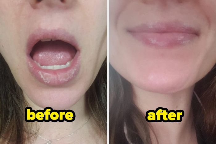 A before-and-after photo from a reviewer showing their chapped lips healed into soft, nourished lips