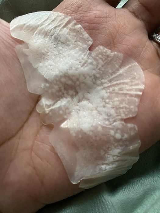 A reviewer shows a close-up photo of their used patch, with large white areas indicating what the sticker absorbed from their skin.