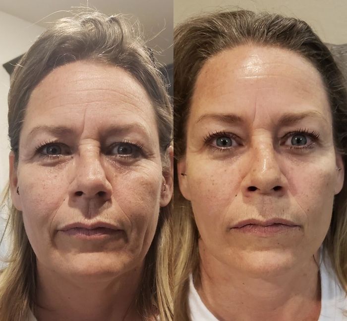 A before-and-after comparison from the reviewer, illustrating how the mask tightened their skin and visibly softened lines on the forehead, around the eyes, and mouth