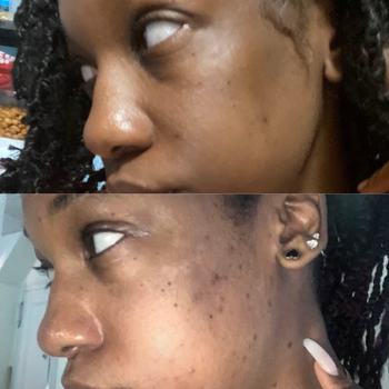 Before and after photo showcasing a reviewer with a balanced skin tone