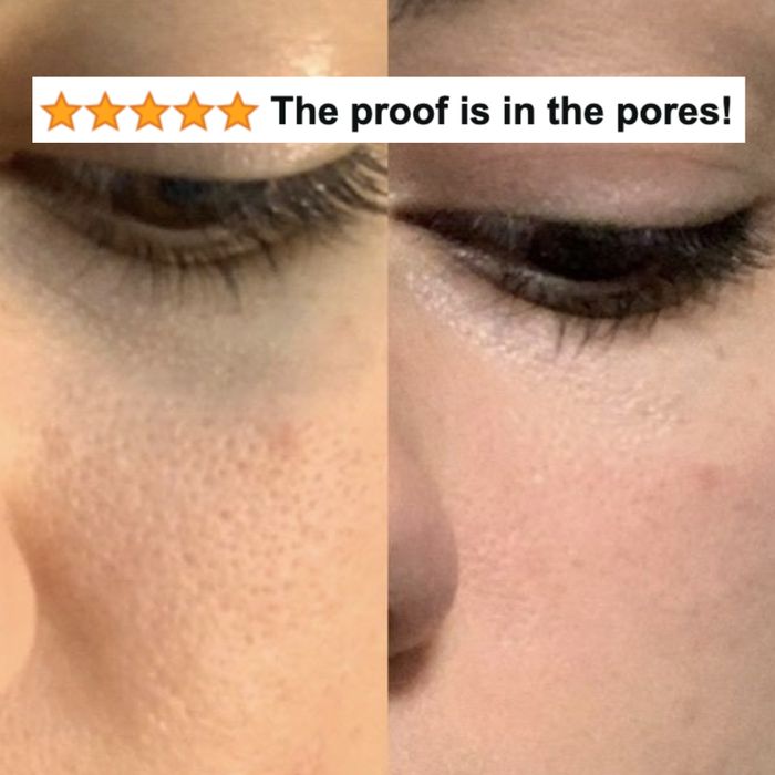 Before and after using the toner: Reviewer's skin results.