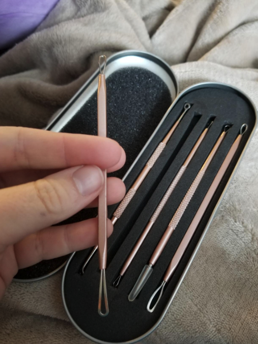 A set of blackhead removal tools that look like metal sticks with various shaped loops on each end. A reviewer holds one from the case.