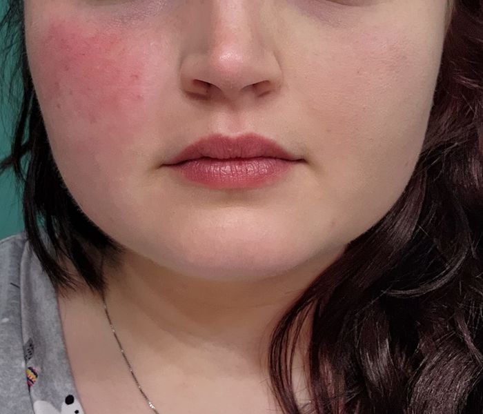 Reviewer demonstrating their skin with and without applying the primer for makeup.