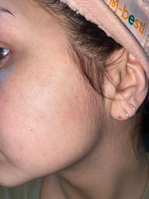 A reviewer showing the fine hairs along their jawline before using the tool