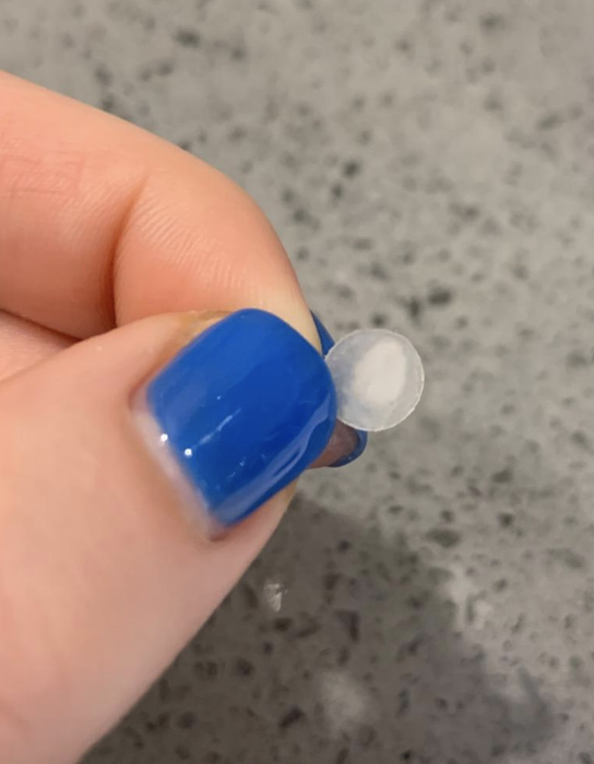 A photo shared by a reviewer displaying the used pimple patch.