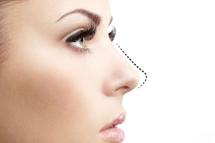 การทำศัลยกรรมจมูก (Rhinoplasty) เป็นการผ่าตัดเพื่อปรับรูปทรงของจมูกให้สวยงามหรือเหมาะสมกับรูปหน้าของผู้ทำ การทำศัลยกรรมนี้มีหลากหลายเทคนิคทั้งแบบเสริมจมูกหรือปรับโครงสร้างกระดูกและเนื้อเยื่อของจมูก เพื่อให้ได้ผลลัพธ์ที่ดีและมีความสวยงามตามความต้องการ