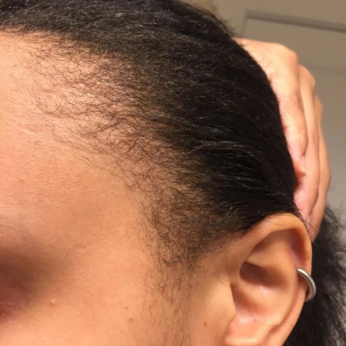 a reviewer's before photo showcasing natural edges and baby hairs