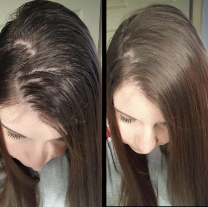 Before and after photos showcasing the effects of dry shampoo