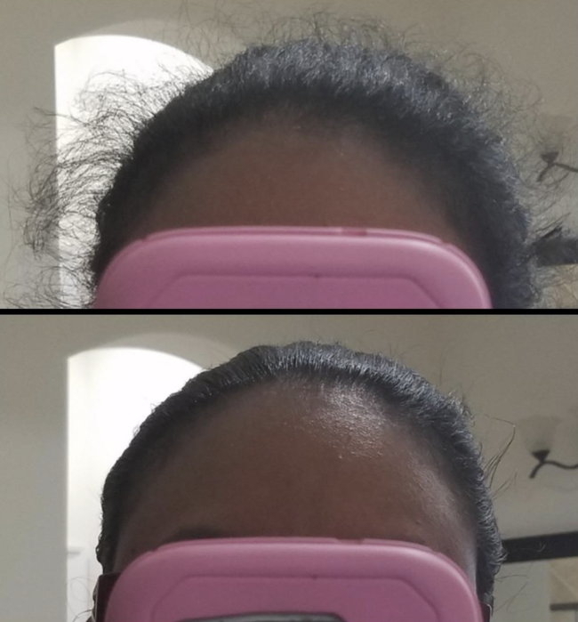 A person with hair pulled back, showing flyaways, then after using the product, the hair appears smooth and neat.