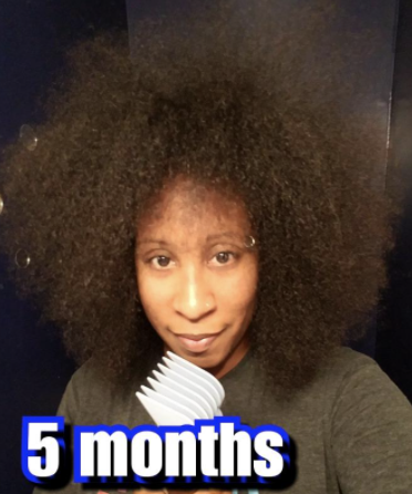 A reviewer demonstrates noticeable hair growth after five months of using the product.