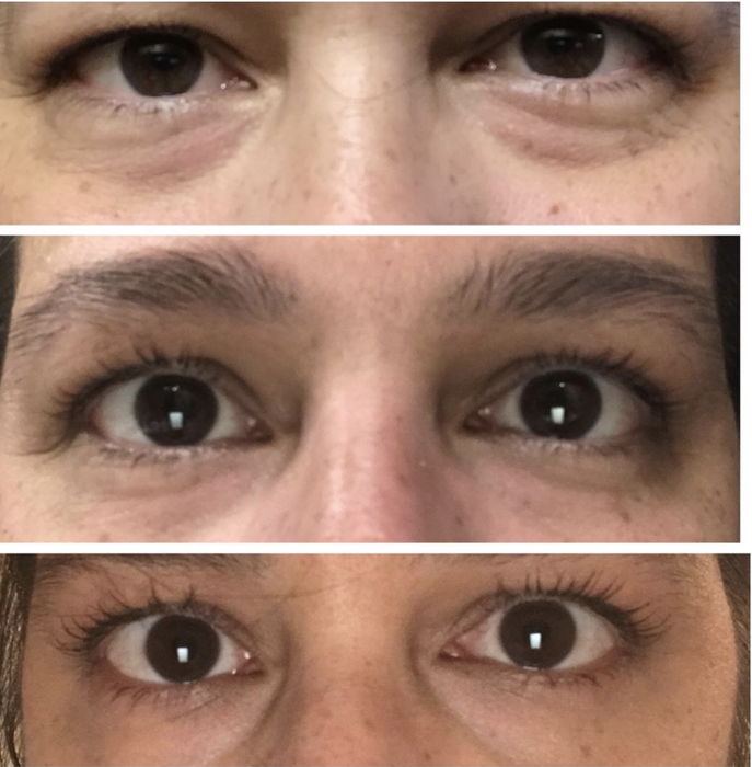 Before and after pictures of a reviewer's under-eye area, showing a noticeable improvement in smoothness