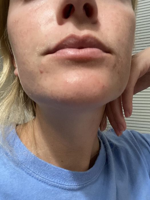 A reviewer's skin following the application of the mist