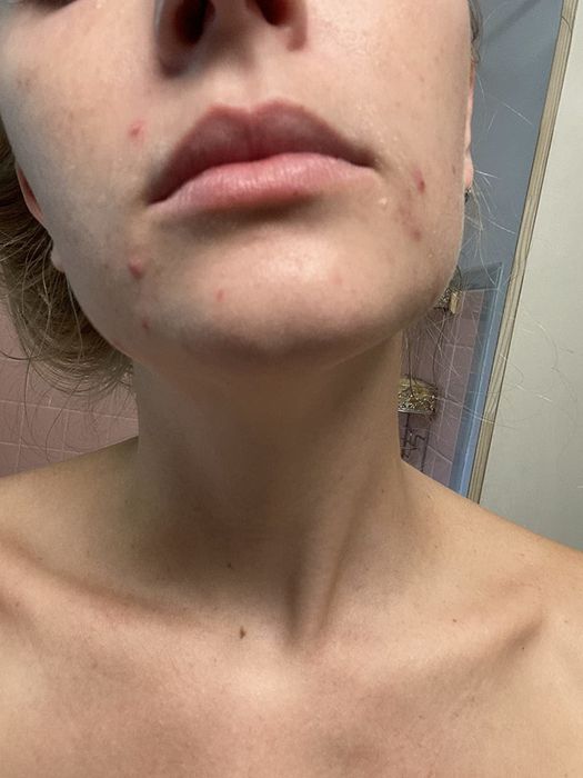 A reviewer's skin prior to using the mist