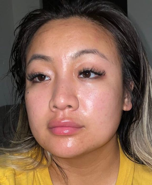 reviewer's face appearing exceptionally smooth and exfoliated