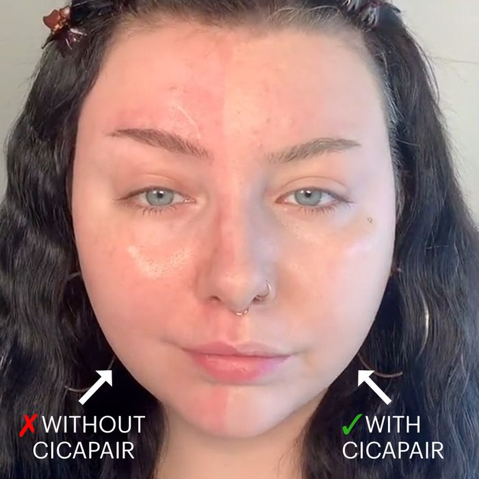 A model with the product applied to one side of their face, leaving the other side untouched
