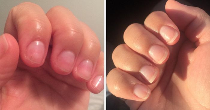 before-and-after photo of a reviewer showing how the cream transformed their nails, making them longer and more resilient