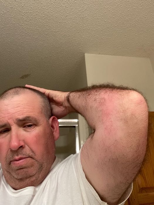 after image of the same reviewer’s elbow now clear and calm