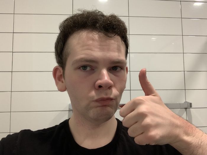 Mytour writer Daniel Boan after using The Ordinary peeling solution.