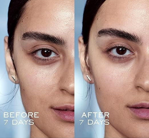 An image split showcasing a model's face before and after a 7-day skincare treatment.