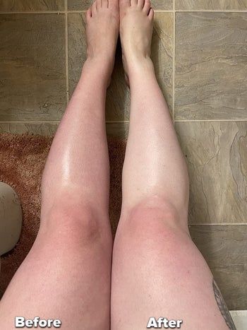 A reviewer showing their legs before and after using the scrub mitt, highlighting the noticeable difference in appearance