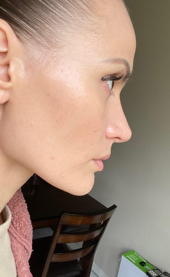 reviewer's glowing skin after using the gel