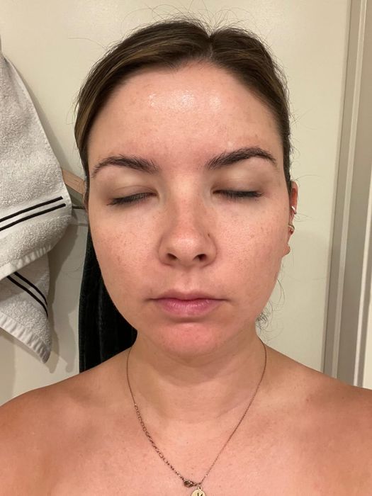 reviewers' skin before using the serum