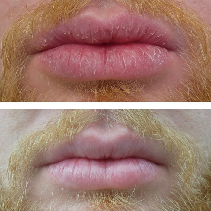 A reviewer’s before/after showing their lips completely healed, with no cracks remaining