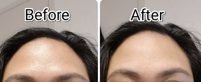 A set of customer photos showing their forehead go from greasy to matte after using the roller