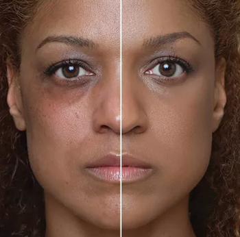 Model showing the before and after results of using the tinted skin conditioner.