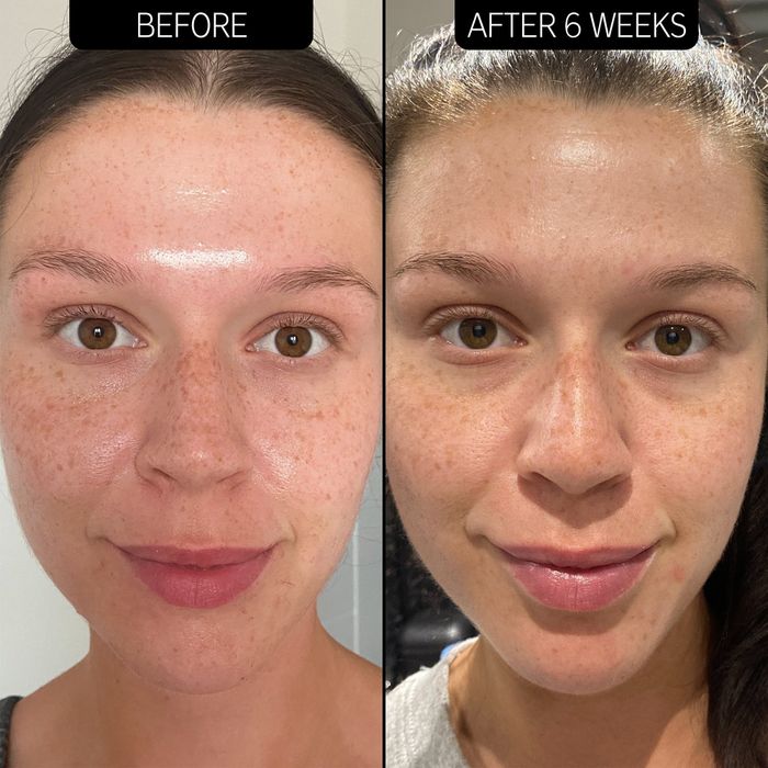 Before and after image of a model using the oil solution, six weeks apart