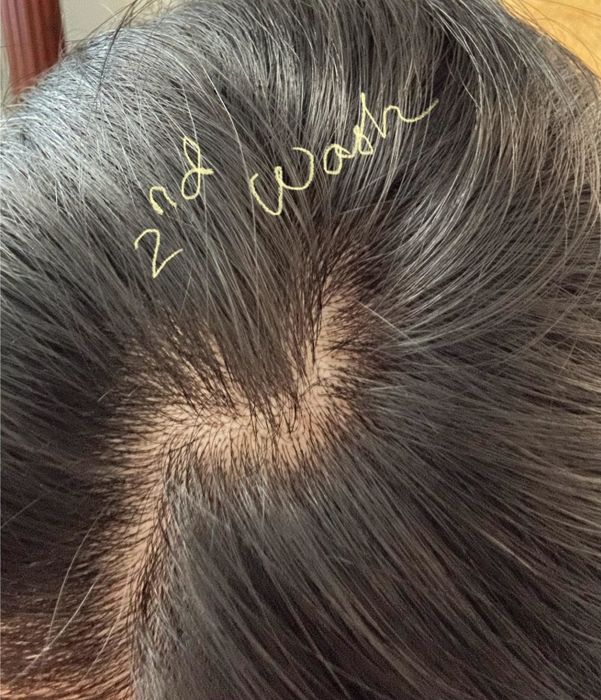 After the second wash with this product, the reviewer's hair shows noticeable improvement.