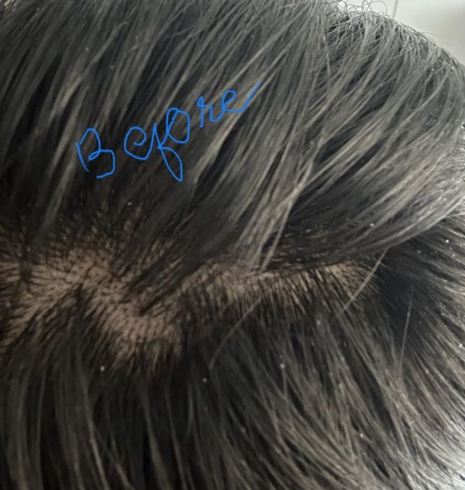 The reviewer’s scalp before using the product.