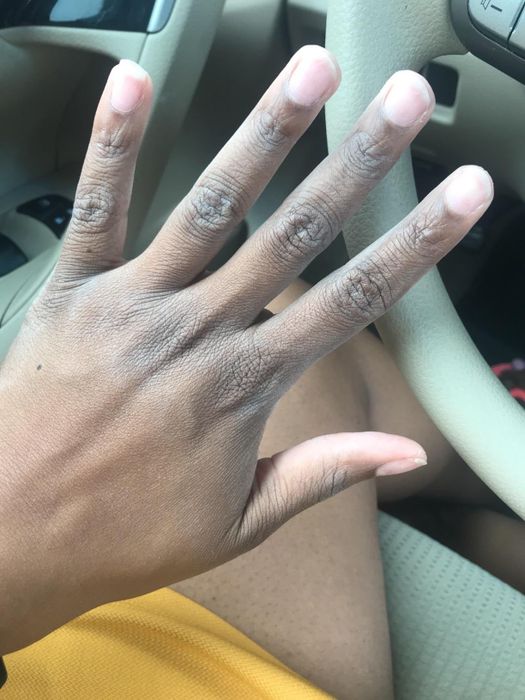 Image showing the reviewer's dry hand.