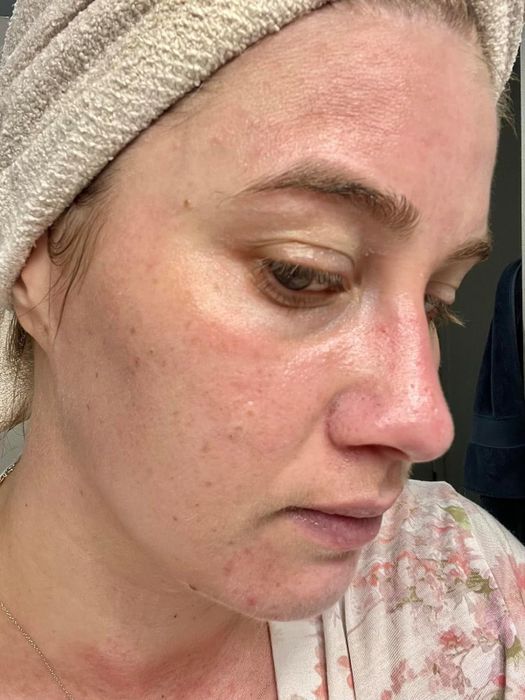A reviewer demonstrates the close-up of their facial skin after applying the sunscreen