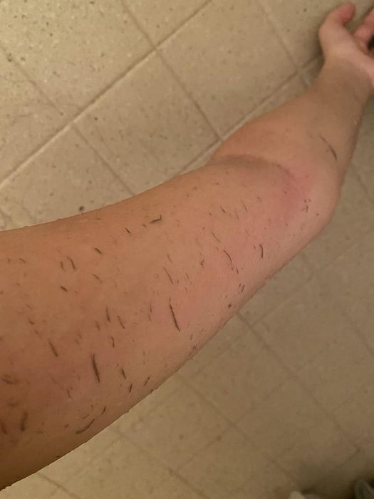 An arm with visible flakes of dead skin on the forearm.