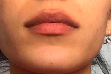 The reviewer's lips appear soft and smooth.