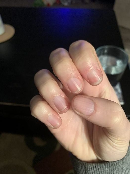 The same reviewer proudly showing off their smooth, soft cuticles after using the serum.