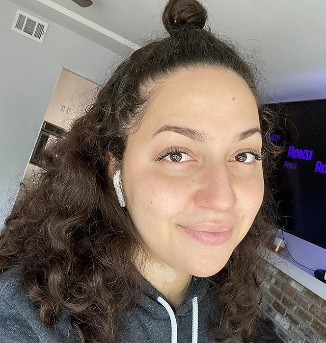 An image of a reviewer with clear and smooth skin after using the serum.