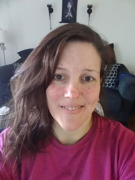 The same reviewer with a clear complexion and no visible red marks on their face